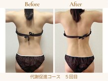 ヨサパーク ククナ 大塚(YOSA PARK kukuna)/