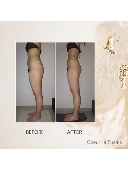 クーラ テュセ(Coeur la Tusais)/【40歳まで】全身まるごと痩身