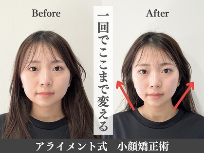 アライメント 自由が丘(Alignment)の写真