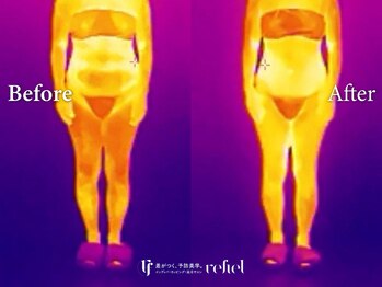 リフィール たまプラーザ店(refiel)/見えるインディバの力