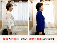 フィール整体院/痛みだけでなく、姿勢も変化！