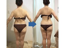 ピュアトゥルー 岐阜西店(PureTrue)/余分なお肉に高周波！ラジオ派！