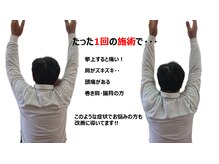 えくぼ整体院/首、肩が辛く挙上出来ない方！