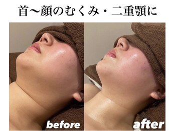 ウィズルーチェ 神栖店(with luce)/１回の変化で小顔効果！二重顎編