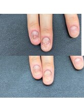 ヒューマン鍼灸接骨院/爪整体で全身の健康をサポート