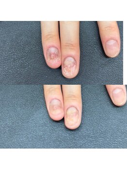 ヒューマン鍼灸接骨院/爪整体で全身の健康をサポート