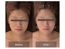 レーヴリゼ(Revelise)/頭蓋骨小顔矯正＋整顔マッサージ