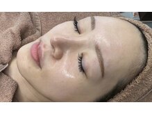 肌悩み改善にララピールがおすすめ☆