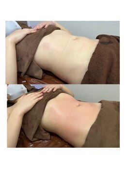 スリーズララ(Cerise LaLa)/