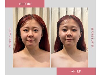 リラル 茅ヶ崎店(RERAR)/首肩顔スッキリします♪