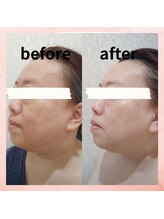 ブライトサロン(Bright Salon)/透明感アップ◎