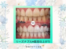 ホワイト つくば店(WHITE)/施術効果