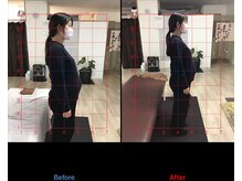 ストレチックス 近江八幡店/マタニティ整体　腰痛・姿勢改善