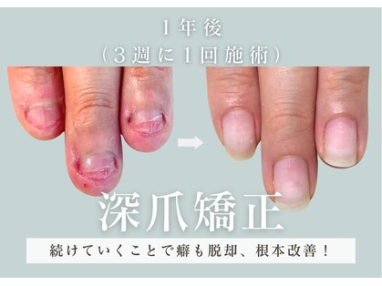 ヴェールリム(verl lim)の写真