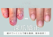 ヴェールリム(verl lim)