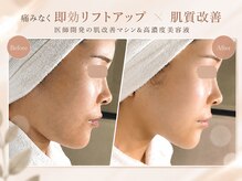 エスラ 中目黒店(S:RA)