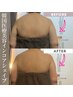 【エステ版オンダリフト】最新韓国痩身ボディケア