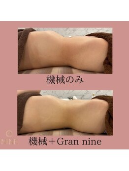 ルミエール(Lumiere)の写真/ 腸活と本格エステで内側から健やかに!めぐりを整え、免疫力アップ&理想の美ボディへ導きます