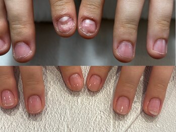 ラグ ネイル(RAG nail)の写真/コンプレ爪を大好きに変えるネイルサロン◎
