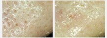 サロン ド ボーテ プルーラ(Salon de beaute PLURA)