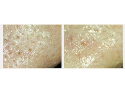 サロン ド ボーテ プルーラ(Salon de beaute PLURA)の写真