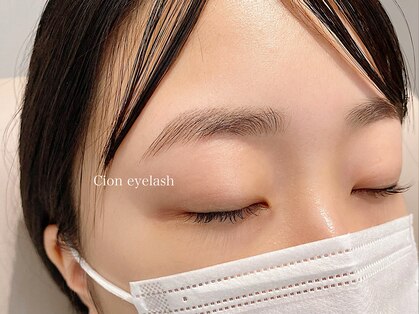 シオン(Cion)の写真