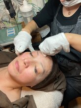 プチュリア(puCuria)/角質除去、シルク糸顔脱毛