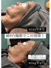 アンベリー ひびきの(embellie)/リフトアップケア