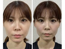 ハレハナ 渋谷駅前店(Hare-Hana)/ブライダルエステ整体の効果