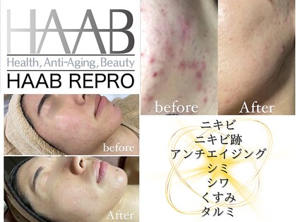 リヤン(Lien)の写真