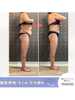 ミノ 美里大通り店(mino)/ダイエットパッケージプラン