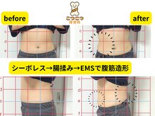 こつこつ接骨院 東麻布 赤羽橋/シーボレスモニター