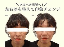 REGISTA ボディ&フェイシャルケアサロン/筋膜リリース/小顔矯正/実例！小顔矯正