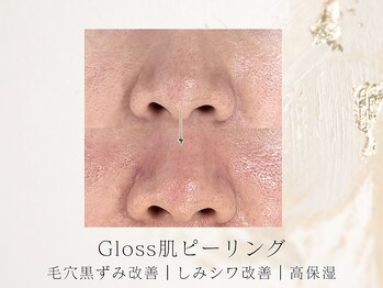 アネラボーテ(Anela Beaute)/Gloss肌ピーリング/いちご鼻改善