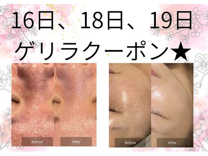 サロンツキ(salon tuki)の写真