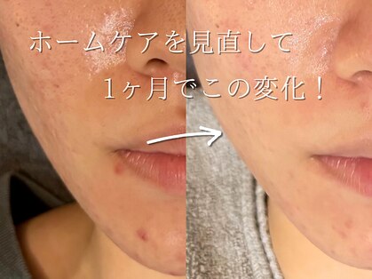 メンズビューティサロン ブレス(bless)の写真
