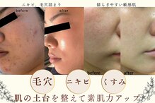 プログレス(PROGRESS)