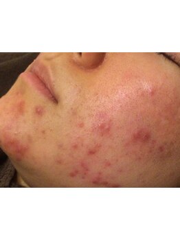 お肌をきれいにしたい