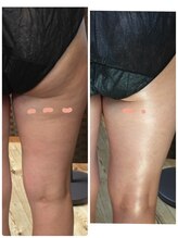 シャンス 輝き(CHANCE 輝き)/1度の変化（個人差はあります）