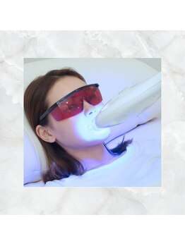 ホワイトニングショップ 下関店/ライト照射します。