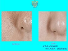 リュクス(LUXE)/ビフォーアフター