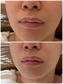 ナナプラス(nana plus)/くすみケア