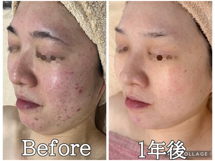 リンダ(Rinda)の写真