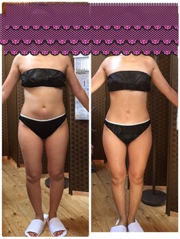 シャンス 輝き(CHANCE 輝き)/1度の変化（個人差はあります）