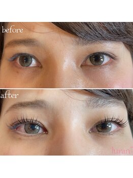 ルラン(luran)/ビフォーアフターです