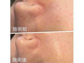 スムース(Smoooth)