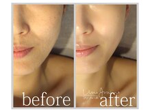 アン グレーヌ 自由が丘(unegraine)/肌が潤うと笑顔も作りやすくなる