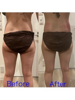 シエル 春日部店(Ciel)/施術効果!