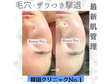 ビューティーツリー(Beauty Tree)