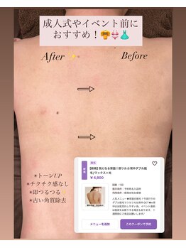 ジョエルワックス 沖縄那覇店(JOELLE WAX)/成人式にぴったりなメニュー★